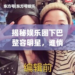 揭秘娛樂圈下巴整容明星，誰悄悄整過下巴？