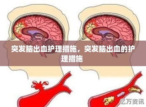 突發(fā)腦出血護(hù)理措施，突發(fā)腦出血的護(hù)理措施 