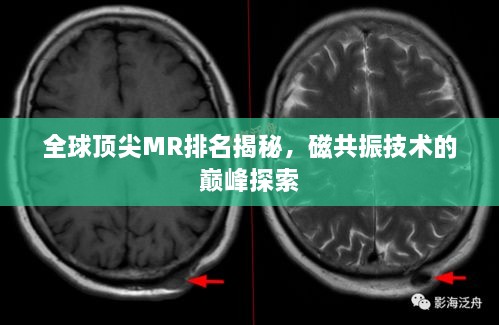 全球頂尖MR排名揭秘，磁共振技術(shù)的巔峰探索