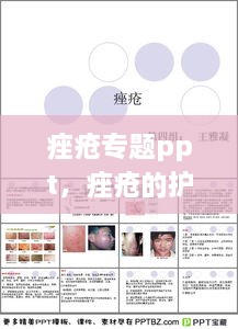 痤瘡專題ppt，痤瘡的護(hù)理ppt 