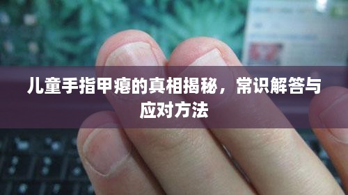 兒童手指甲癟的真相揭秘，常識解答與應(yīng)對方法