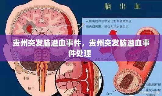 貴州突發(fā)腦溢血事件，貴州突發(fā)腦溢血事件處理 